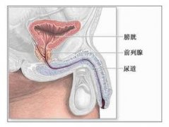 前列腺增生的症状