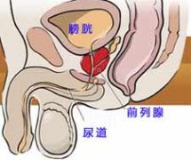 前列腺囊肿的原因有哪些