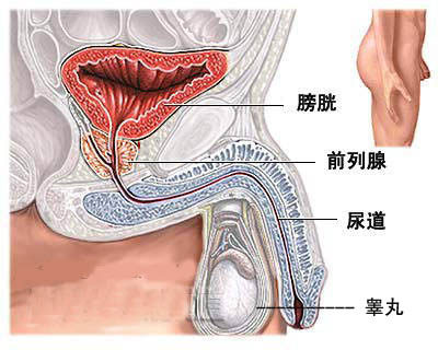 前列腺炎